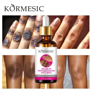 Kormesic Knuckles Whitening Serum 50ml – Brightening Care for Dark Knuckles